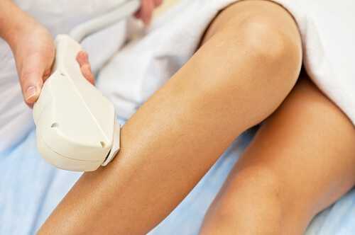 Laser Hair Removal