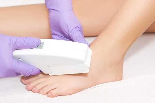 Electrolysis - hair removal