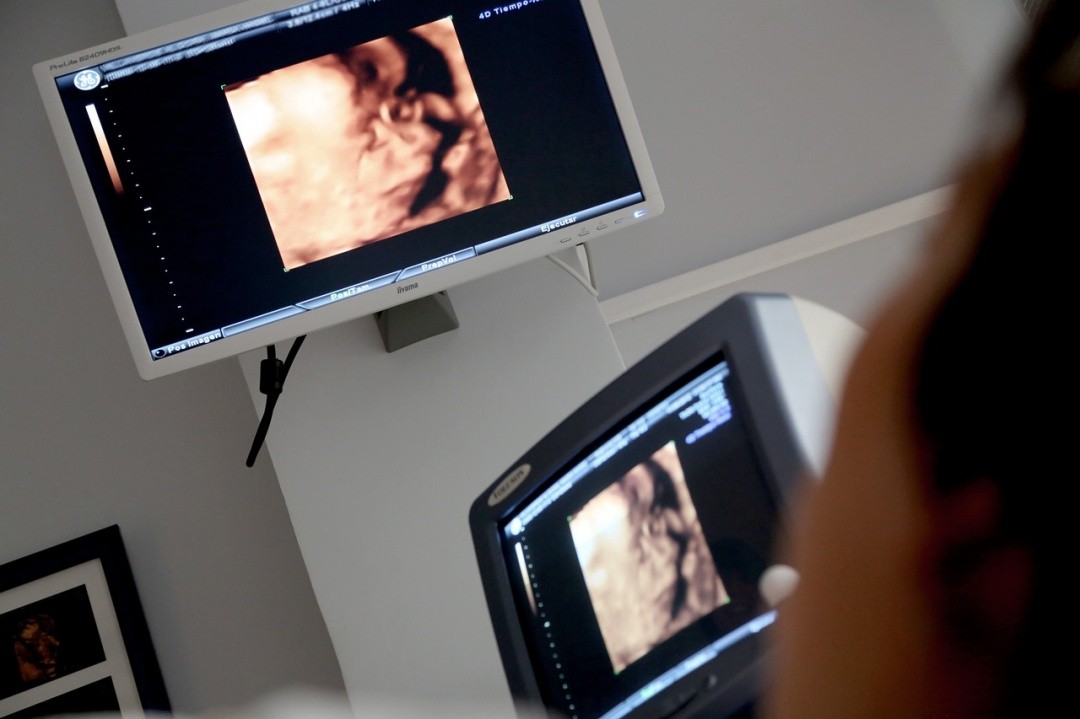 Diagnostic medical sonography