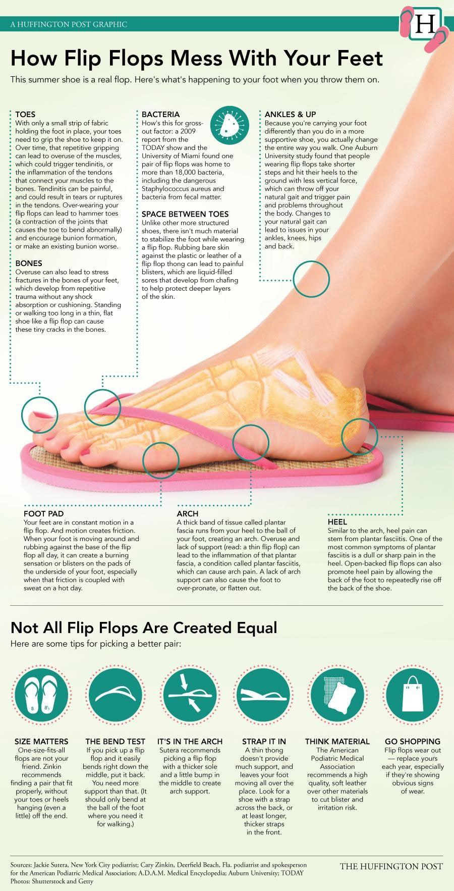 Flip Flops