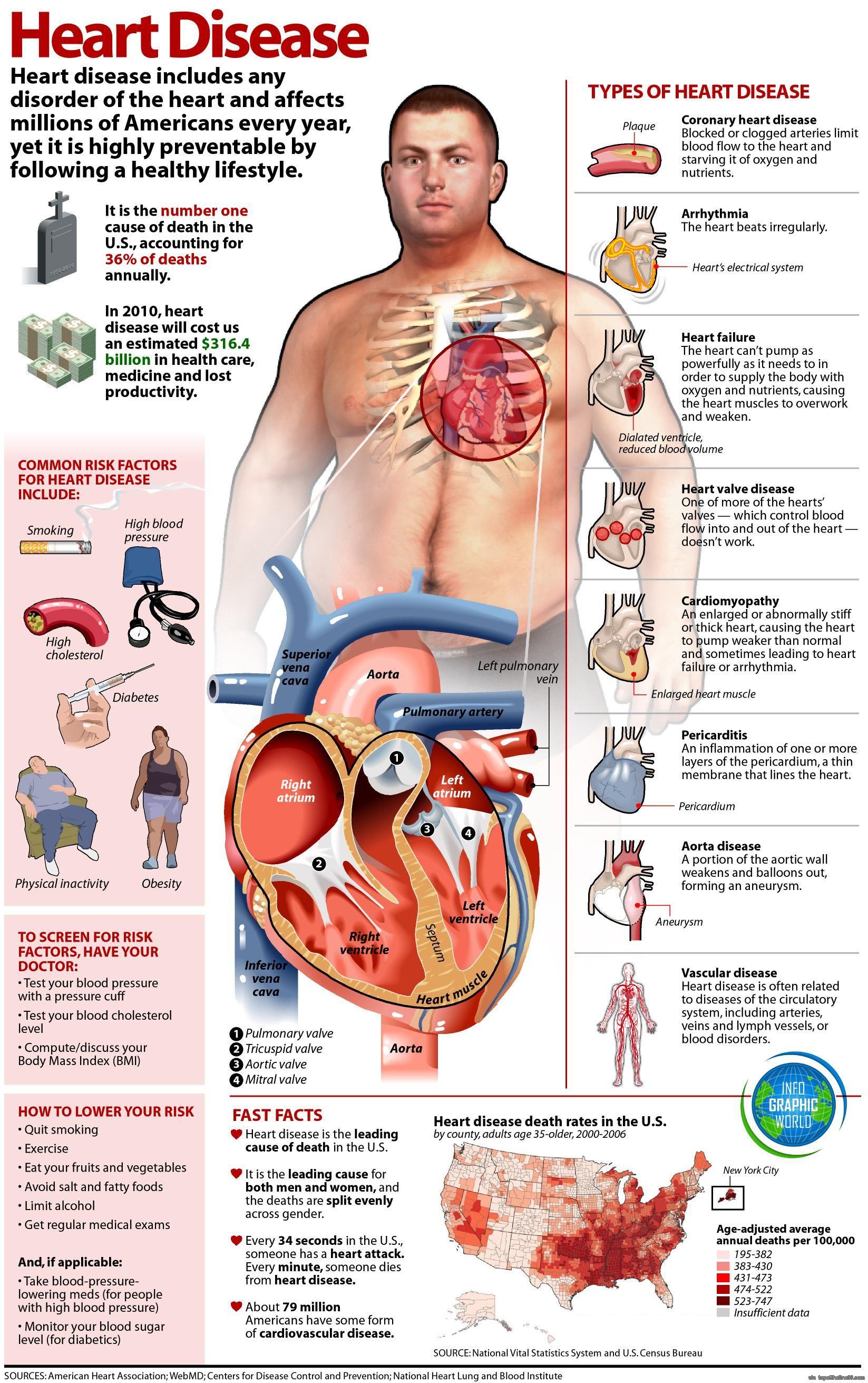 Heart Disease